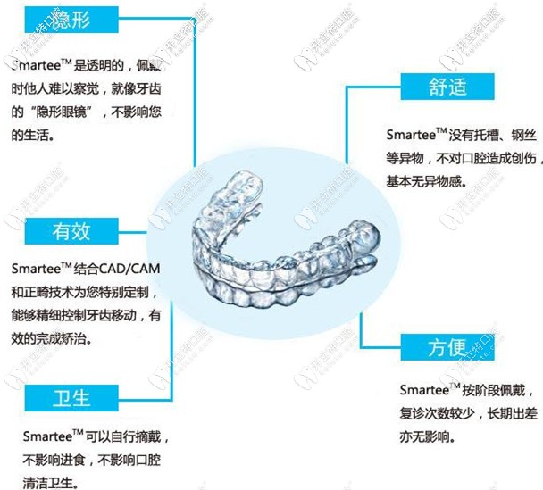 隱形矯正的特點