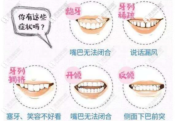 你的牙齒有這幾種情況嗎？