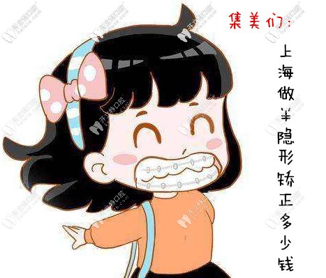 送來上海半隱形矯正牙齒的價格表,各品牌的正畸費用都有哦