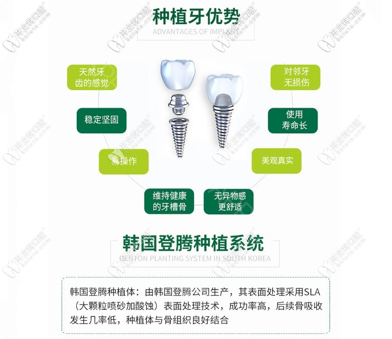 韓國登騰種植牙怎么樣