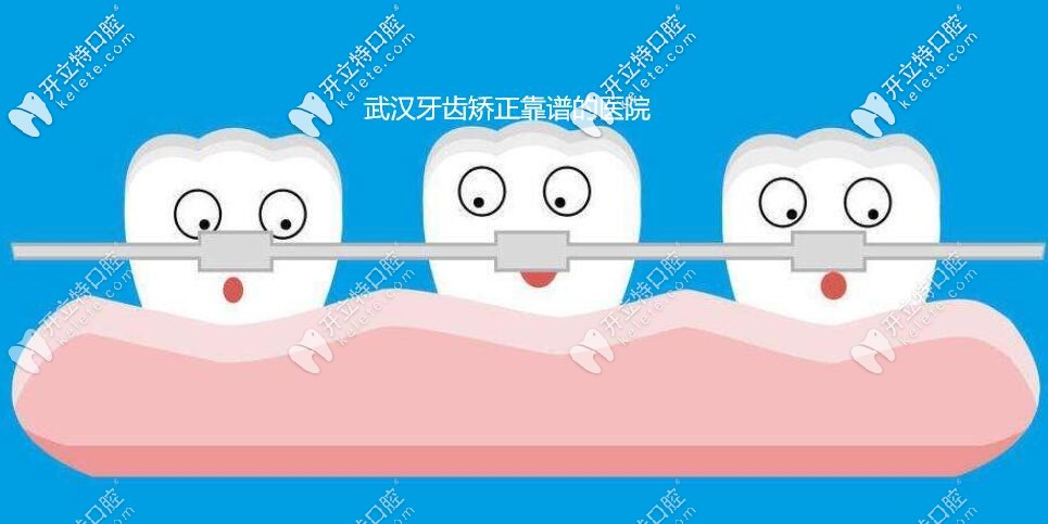 比選擇武漢靠譜的牙齒矯正醫(yī)院更重要的是正畸醫(yī)生,知道嘛