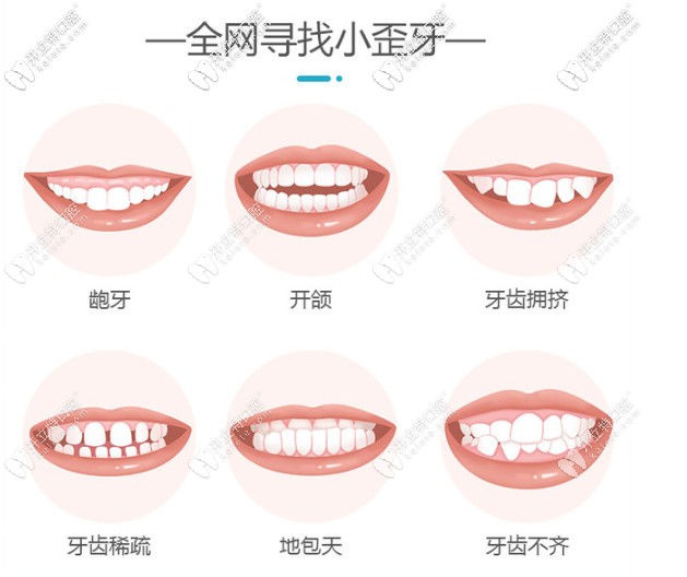 為什么要矯正牙齒