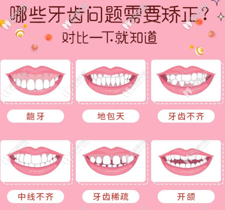 搞不清楚自己需不需要整牙，對(duì)比下就知道