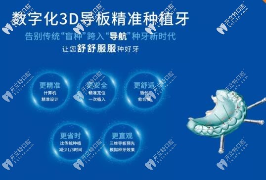 數(shù)字化3d導板種植牙