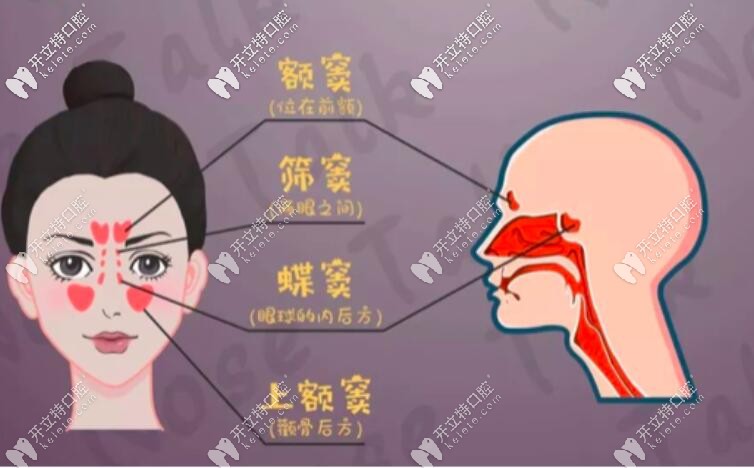 怎么判斷上頜竇穿孔