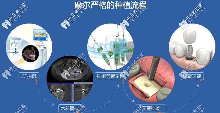 想打聽下昆山看牙哪家牙科靠譜？收費便宜還能用醫(yī)?？ǖ? border=