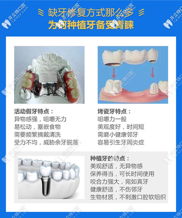 誰有成都圣貝牙科醫(yī)院種植牙價(jià)格表?聽說費(fèi)用不是很高哦!
