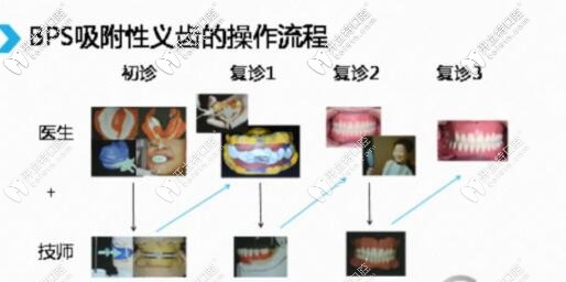 bps制作流程
