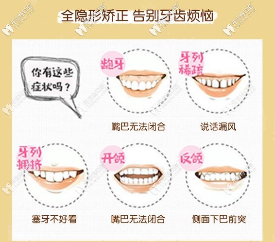 時代天使隱形矯正適應(yīng)癥