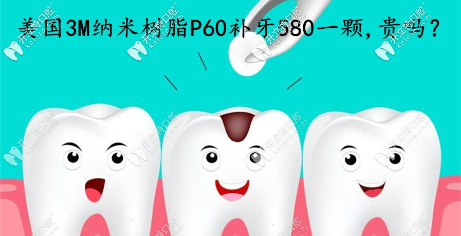 在煙臺做美國3MP60納米樹脂補牙580一顆，這費用算貴嗎
