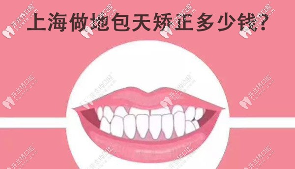 想知道在上海正規(guī)牙科做地包天矯正的費用大概是多少嗎？