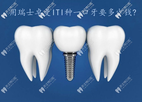 在西安用瑞士ITI種一口牙的價(jià)錢是多少?全口種植費(fèi)用上線咯