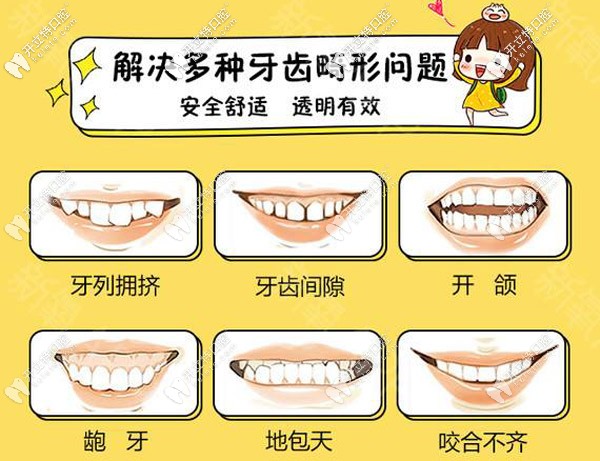 多種牙齒畸形的情況可通過(guò)矯正解決