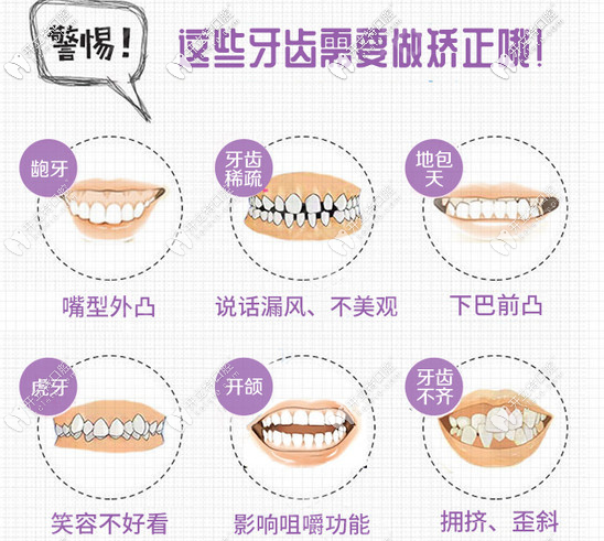 那些牙齒癥狀需要牙齒矯正
