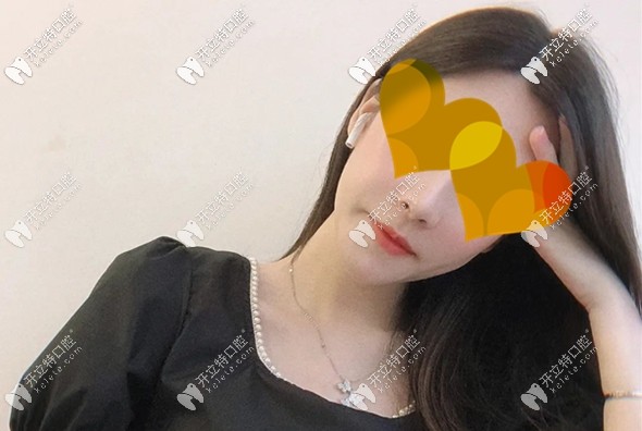 吳小姐做完正頜術(shù)后3個(gè)月效果圖