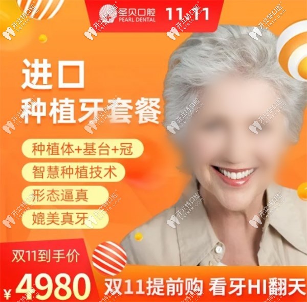 北京朝陽圣貝做韓系進(jìn)口種植牙價(jià)位4980元起，雙11buy