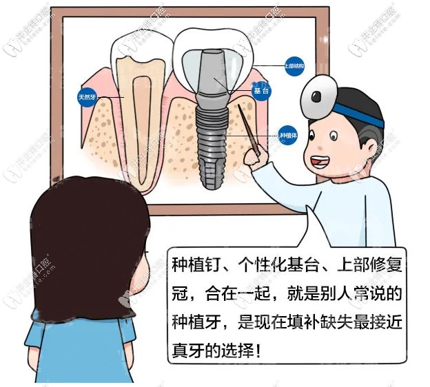 在廣州穗華口腔做1顆諾貝爾種植牙多少錢?過程疼不疼呢！
