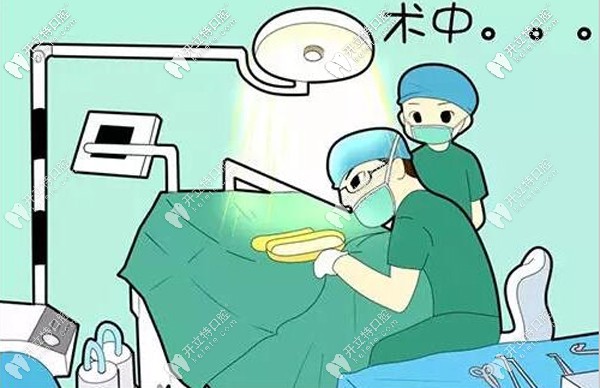 種植牙手術過程示意圖
