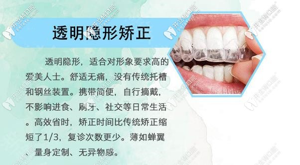 全隱形牙套優(yōu)勢(shì)