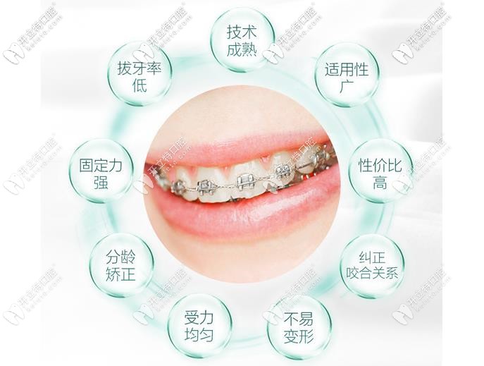 金屬托槽矯正優(yōu)點