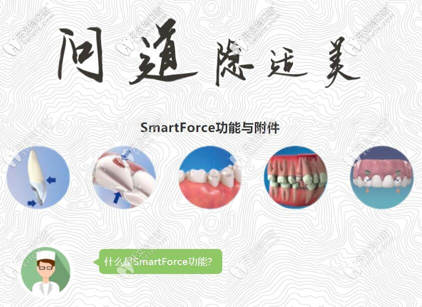 為啥醫(yī)生矯正骨性齙牙更偏愛應用隱適美SmartForce呢