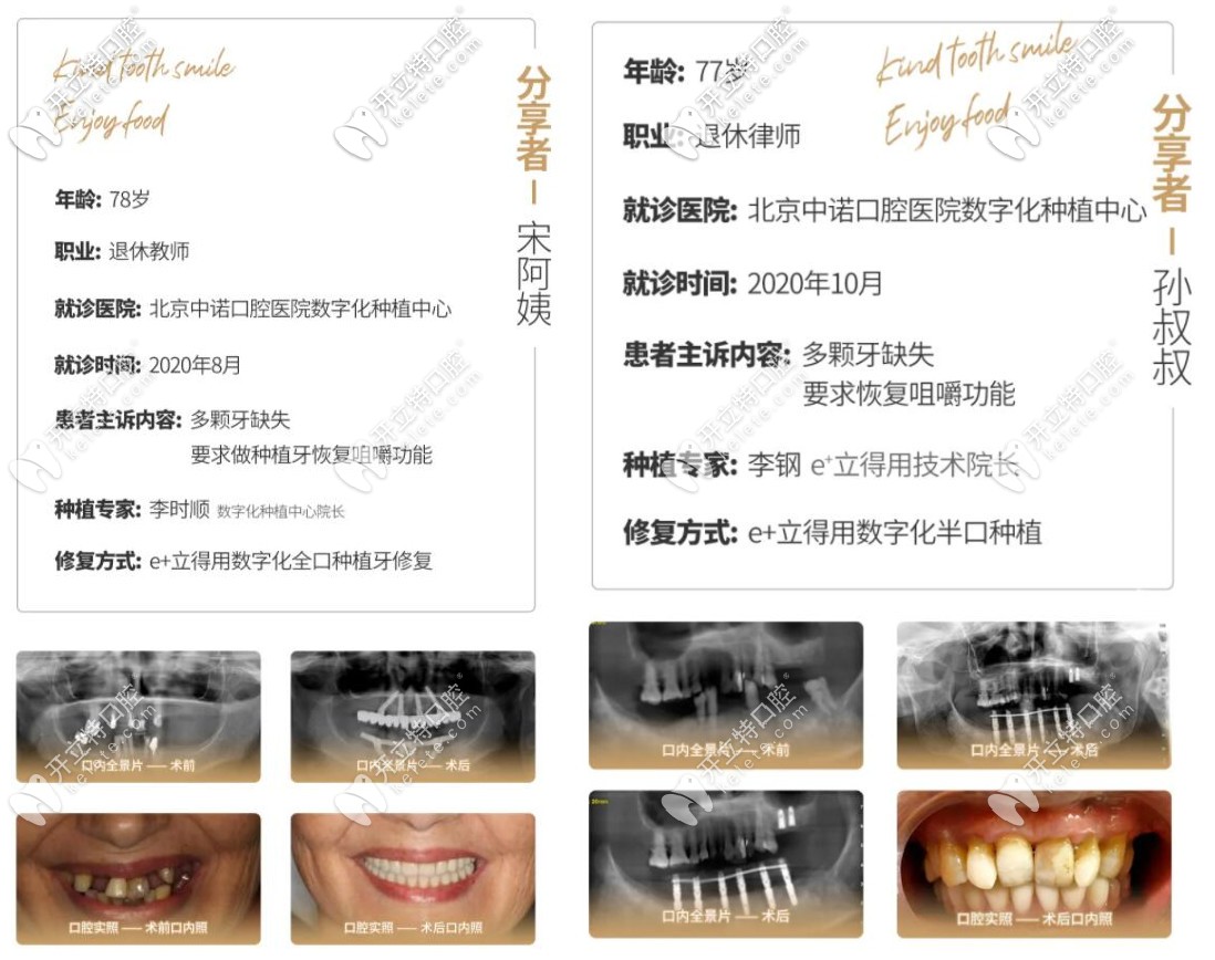 在中諾做半口種植牙和全口種植牙的老人的真實<span style=