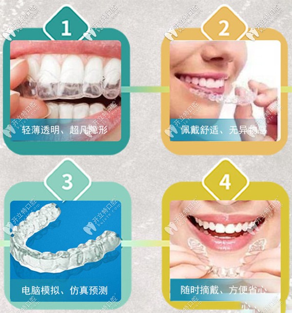 做隱形矯正優(yōu)勢(shì)