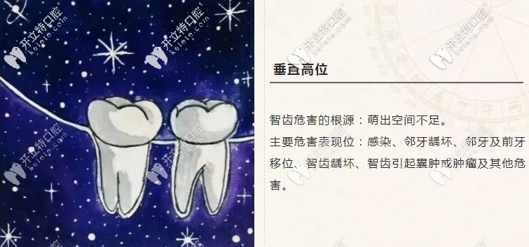 垂直高位