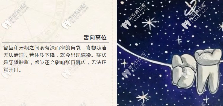 舌向高位
