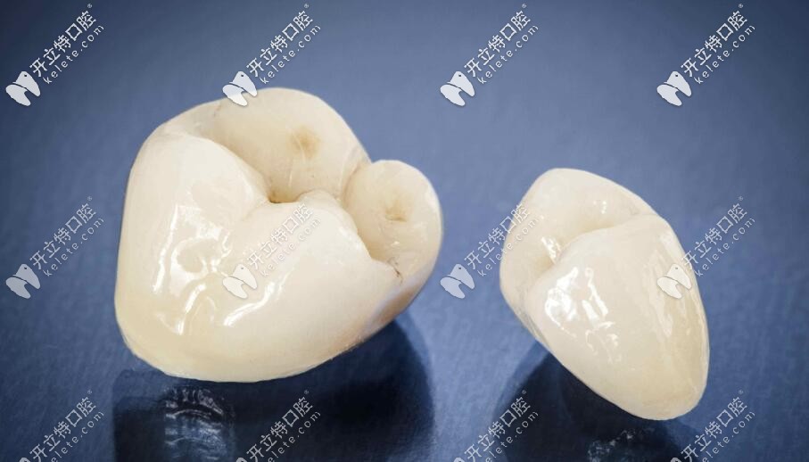 問:紫晶全瓷牙屬于哪個(gè)國(guó)家的材料,它的優(yōu)勢(shì)在哪