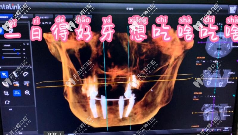 北京昌平哪里看牙比較好？排名前三的牙科診所便宜又好