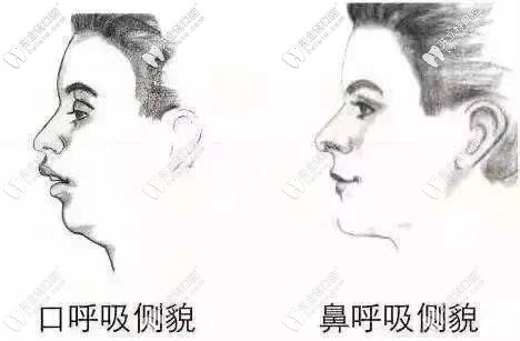 面部變殘