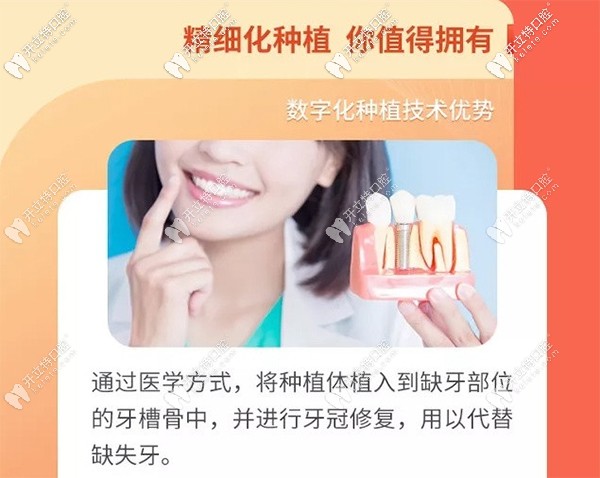 昆明竹子口腔做瑞典Astra即刻種植牙怎么樣？真實(shí)評(píng)價(jià)來(lái)襲