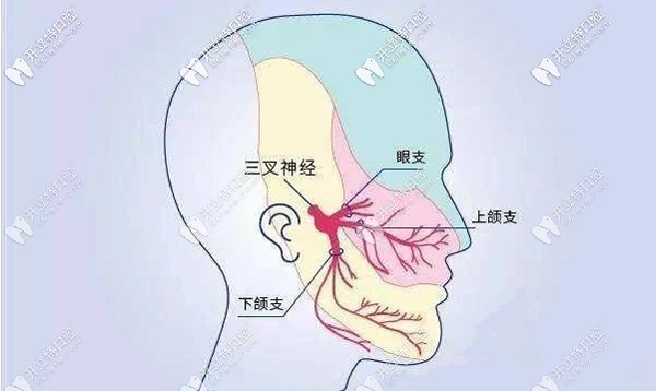 三叉神經(jīng)痛也會引起牙疼
