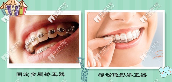 2025海口微笑口腔醫(yī)院牙齒矯正價(jià)格表