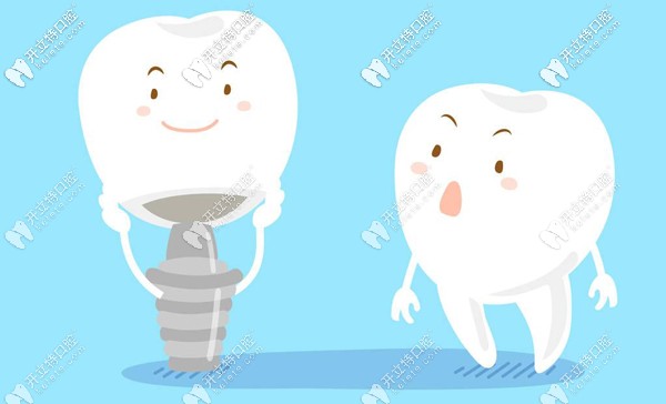 解鎖佛山曙光金子口腔種植牙多少錢一顆？技術(shù)可靠嗎~