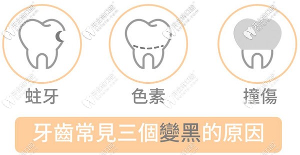 兒童牙齒黑斑是什么原因引起的，需要治療嗎？