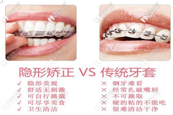 承德可米口腔牙齒矯正費用