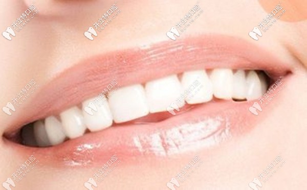 咸陽市牙科醫(yī)院牙齒美白修復(fù)的價(jià)格