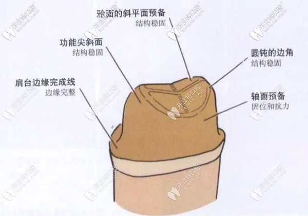 頜面的牙冠預備工作