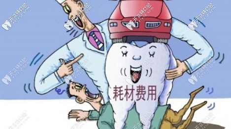 不同植體價(jià)格不一樣