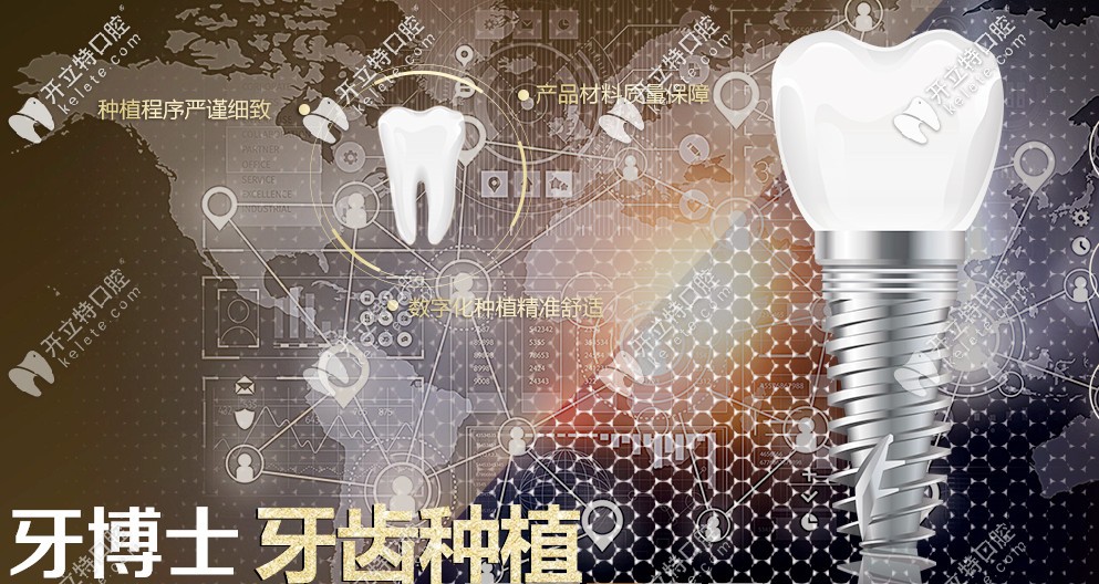 重慶牙博士種植牙的優(yōu)勢(shì)