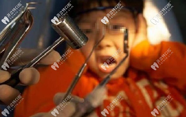 關(guān)于小朋友束縛治療牙齒：兒童補牙束縛治療安全嗎？