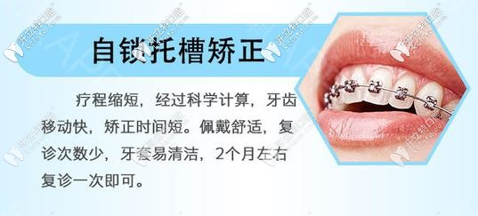 國產(chǎn)指定金屬自鎖矯正器優(yōu)勢