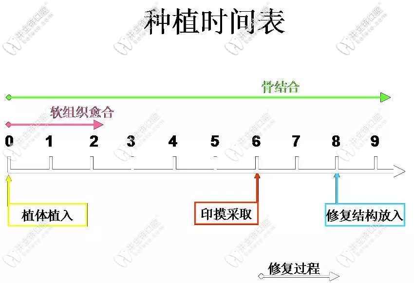 種植牙時間表