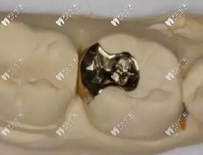 醫(yī)生技術(shù)不豐富，材料填充不嚴(yán)密