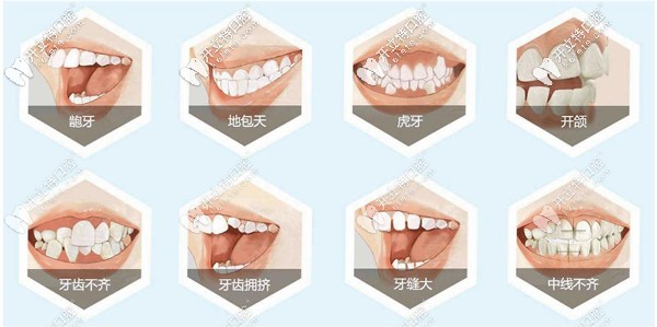 蕪湖矯正牙齒哪家好，這整牙正規(guī)的蕪湖牙科醫(yī)院排名得看