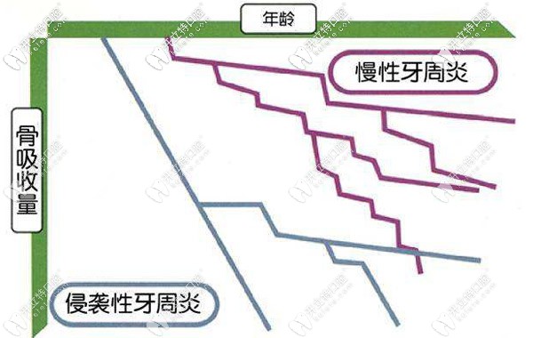 為什么有人會(huì)得侵襲性牙周炎
