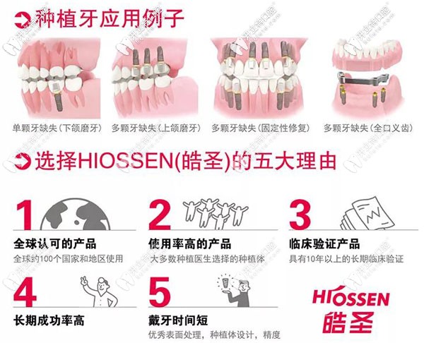 皓圣ETIII SA種植體，支持延期種植又擅于即刻種植