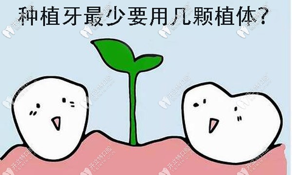 全口種植牙較少要做多少顆？其實(shí)跟種牙方案的選擇有關(guān)